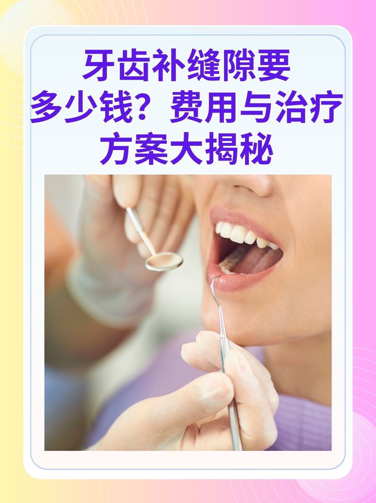 莆田补牙医保可以报销吗(补牙医保可以报销吗 哪些可以报销呢)